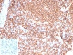 CD45RA Rabbit anti-Human, Clone: PTPRC/7019R, Novus Biologicals 100 &mu;g | Buy Online | Novus Biologicals | Fisher Scientific